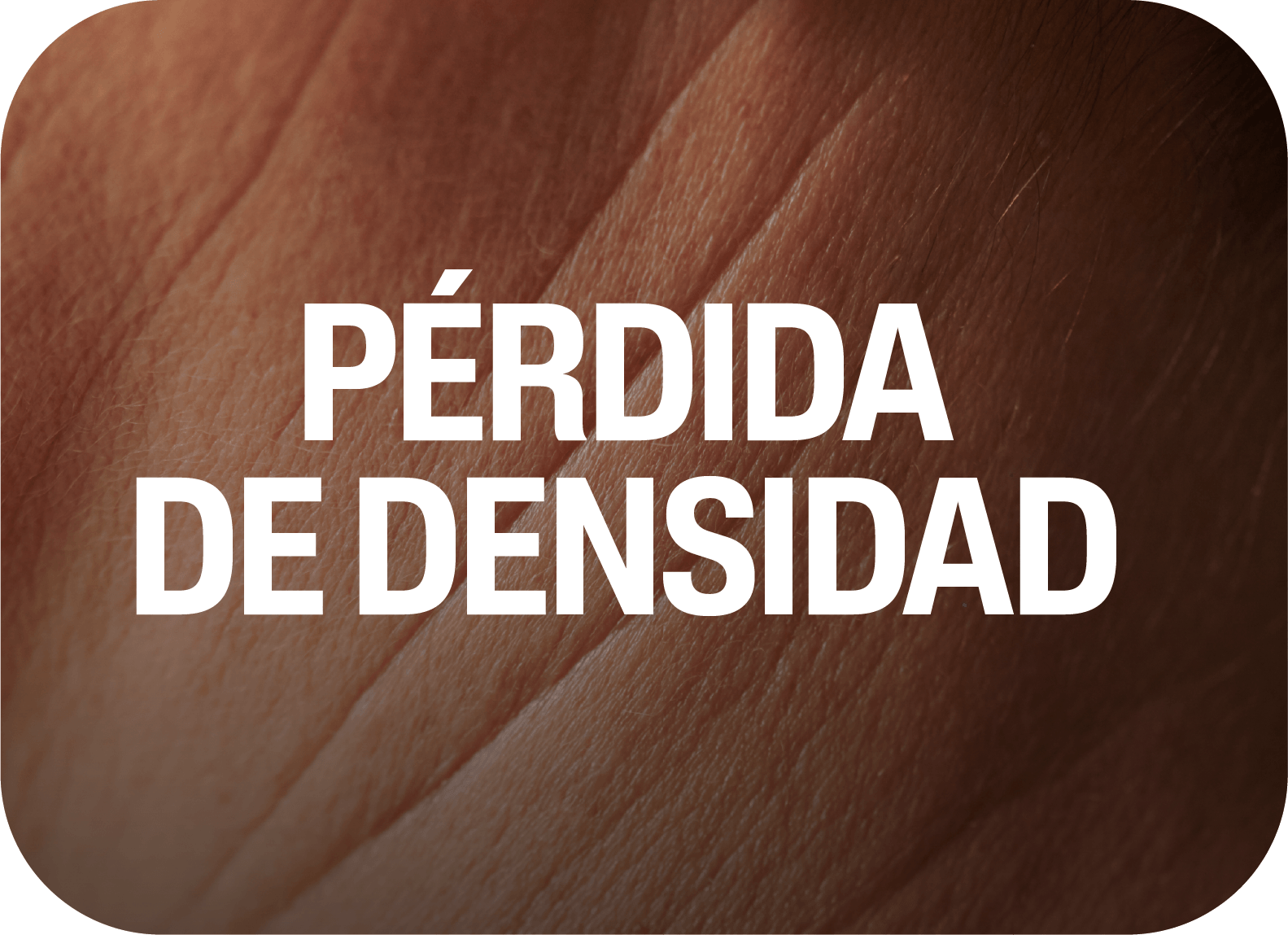 Pérdida de densidad