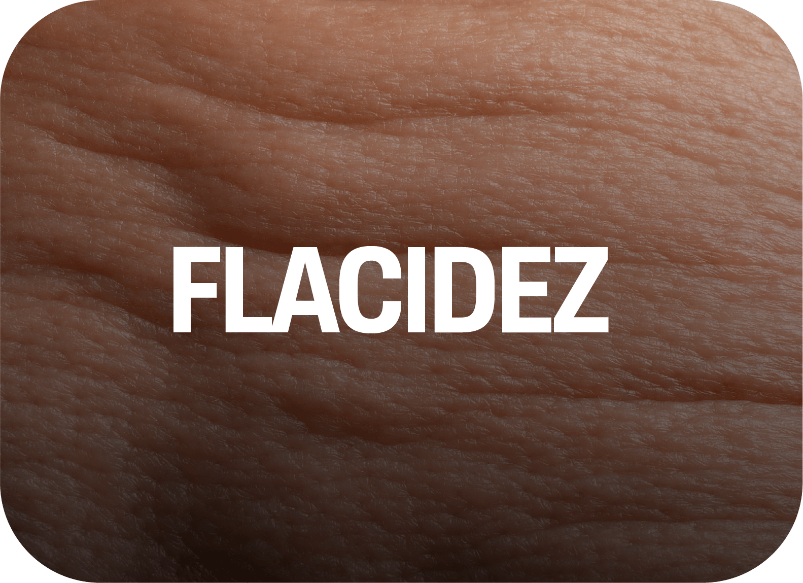 Flacidez