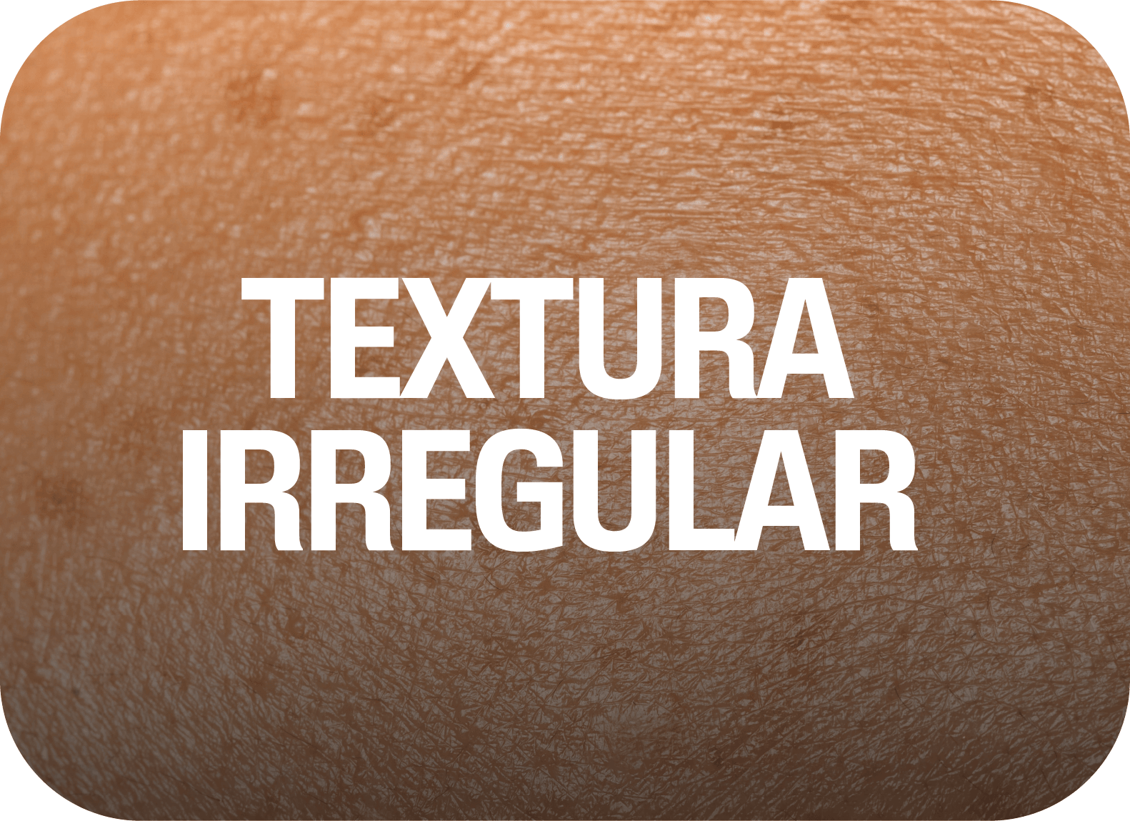 Textura irregular