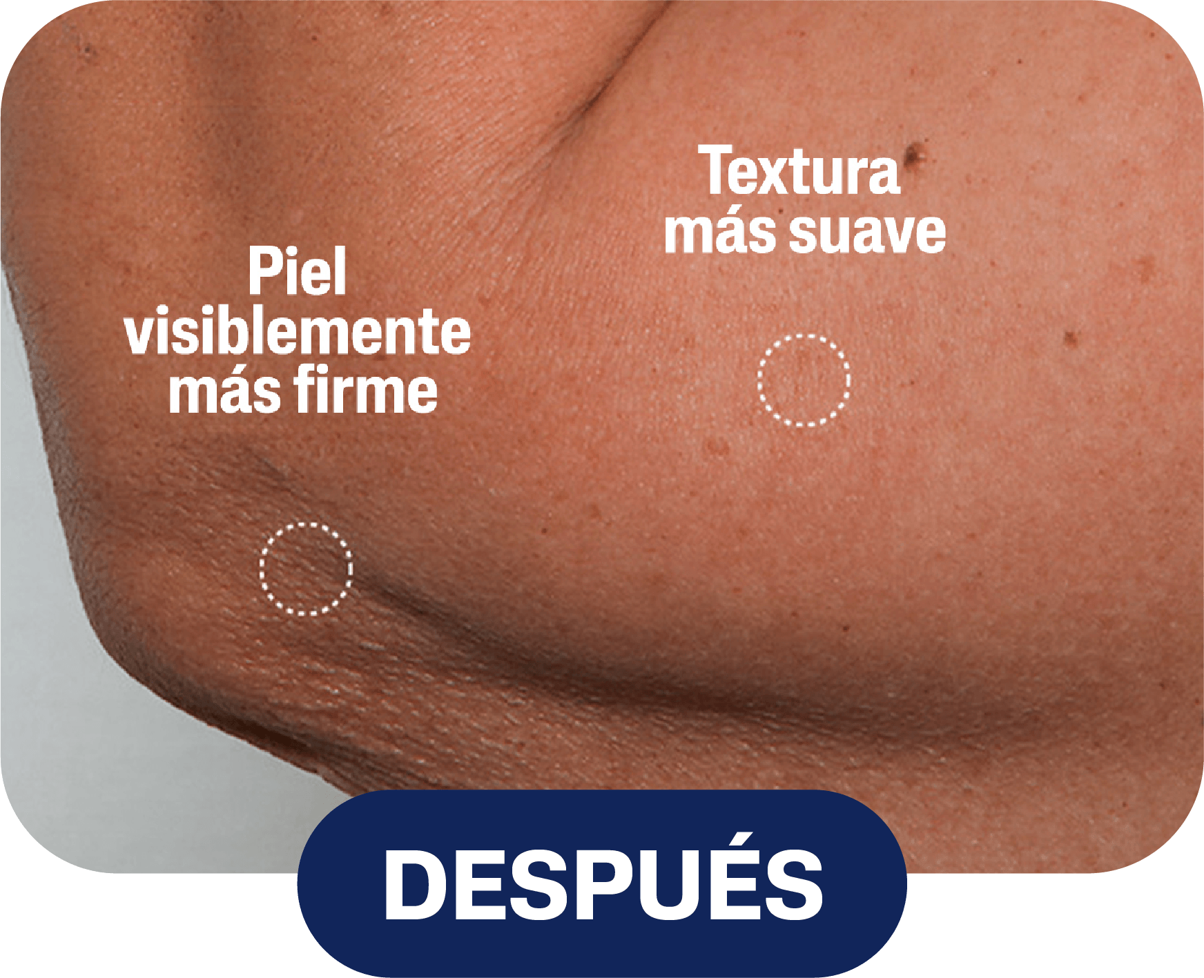 Después