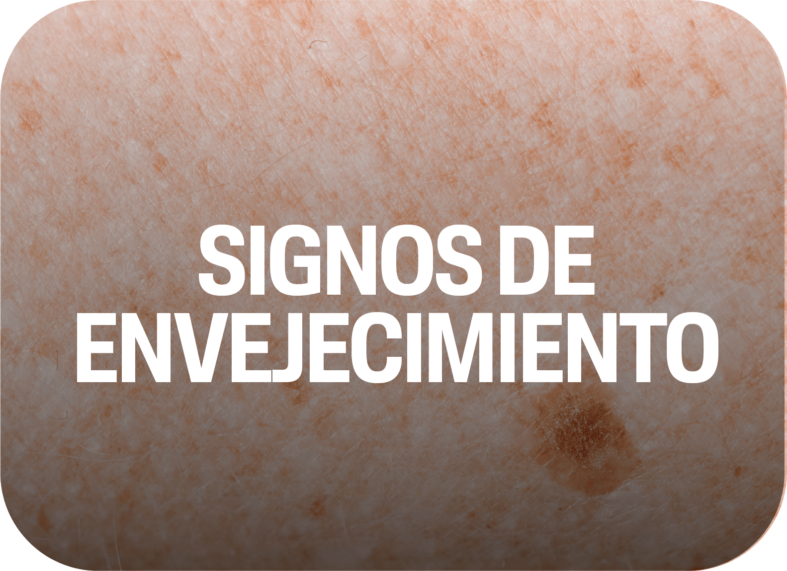 Signos de envejecimiento