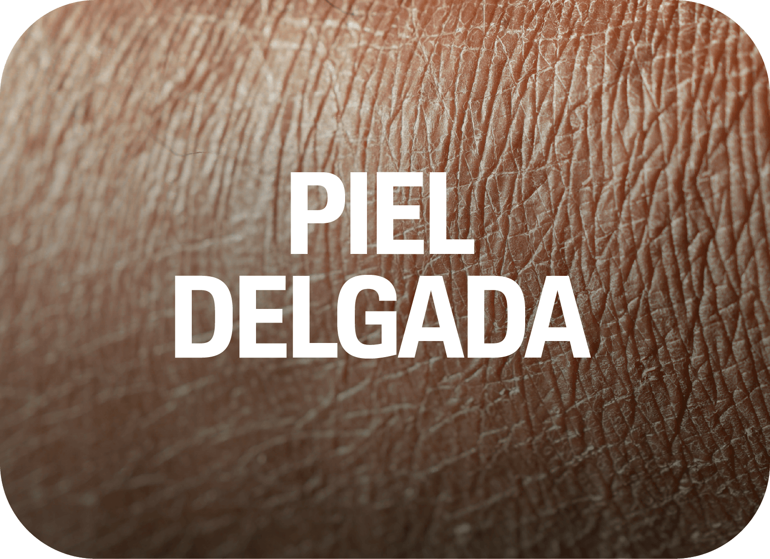 Piel delgada