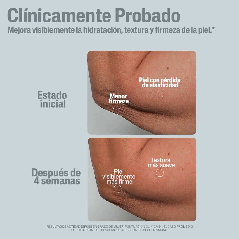Cl&iacute;nicamente probado: antes y despu&eacute;s brazos
