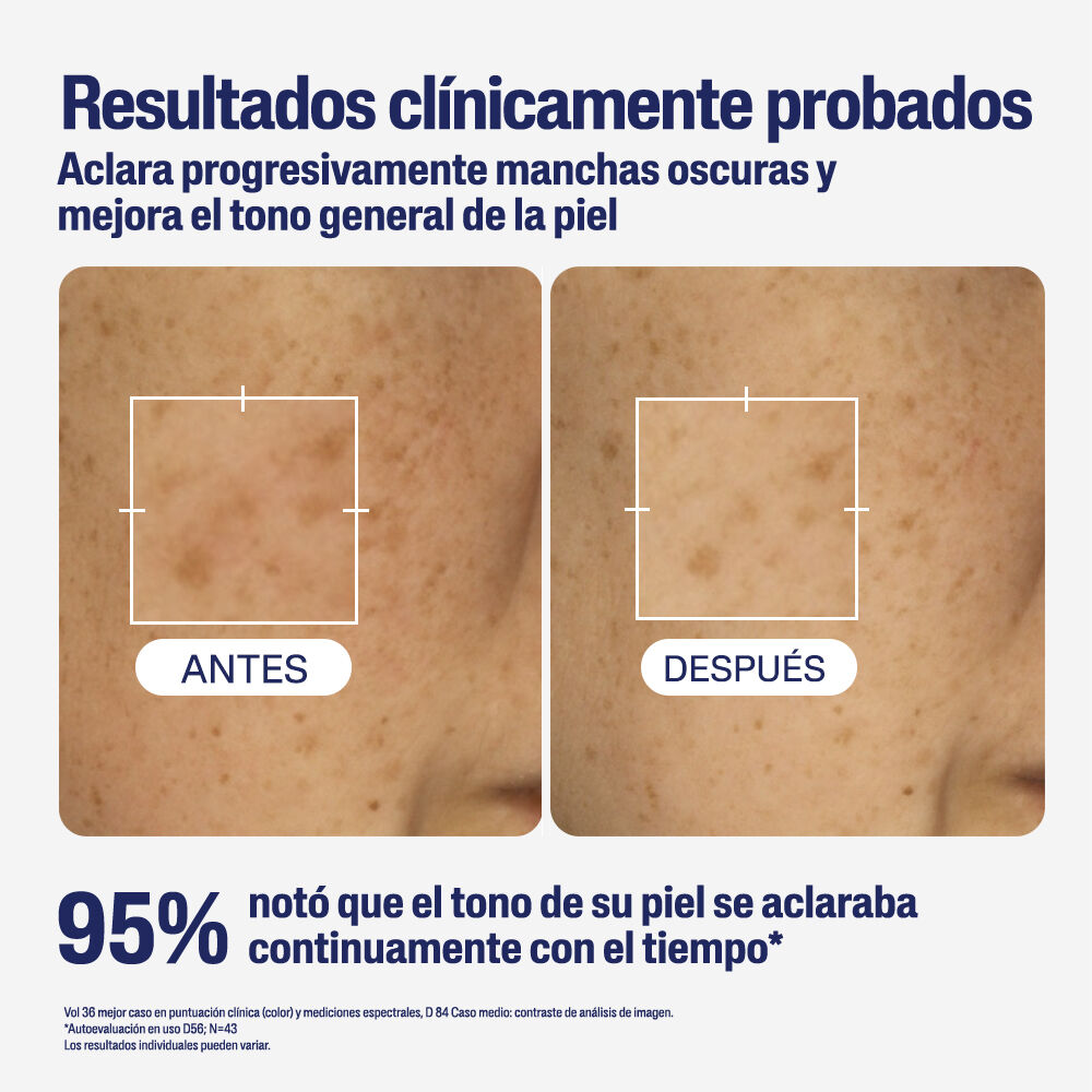 Resultados Antes y Despu&eacute;s S&eacute;rum Antimanchas