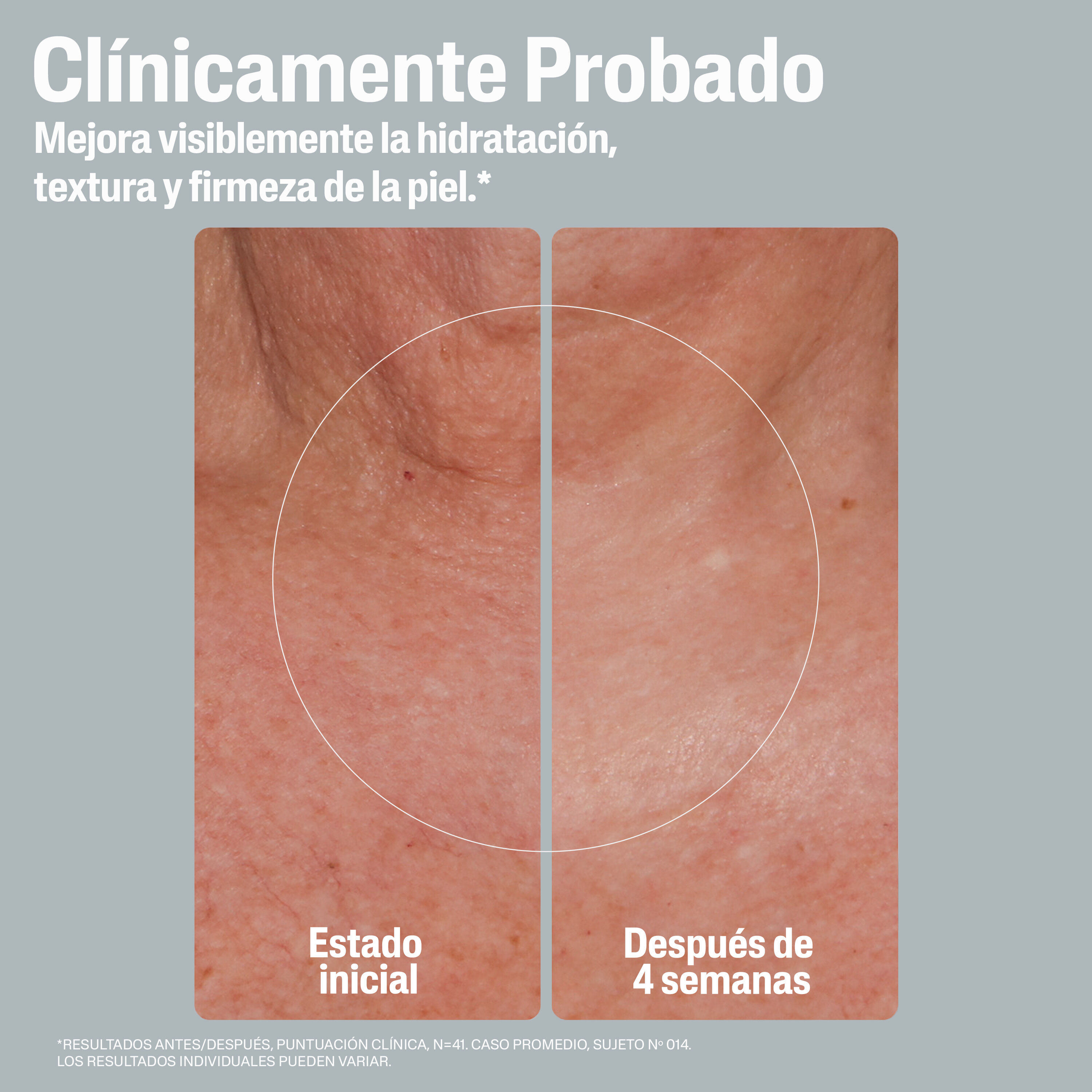 Antes y despu&eacute;s loci&oacute;n hidratante reafirmante CETAPHIL en cuello: mejora de hidrataci&oacute;n, textura y firmeza en 4 semanas
