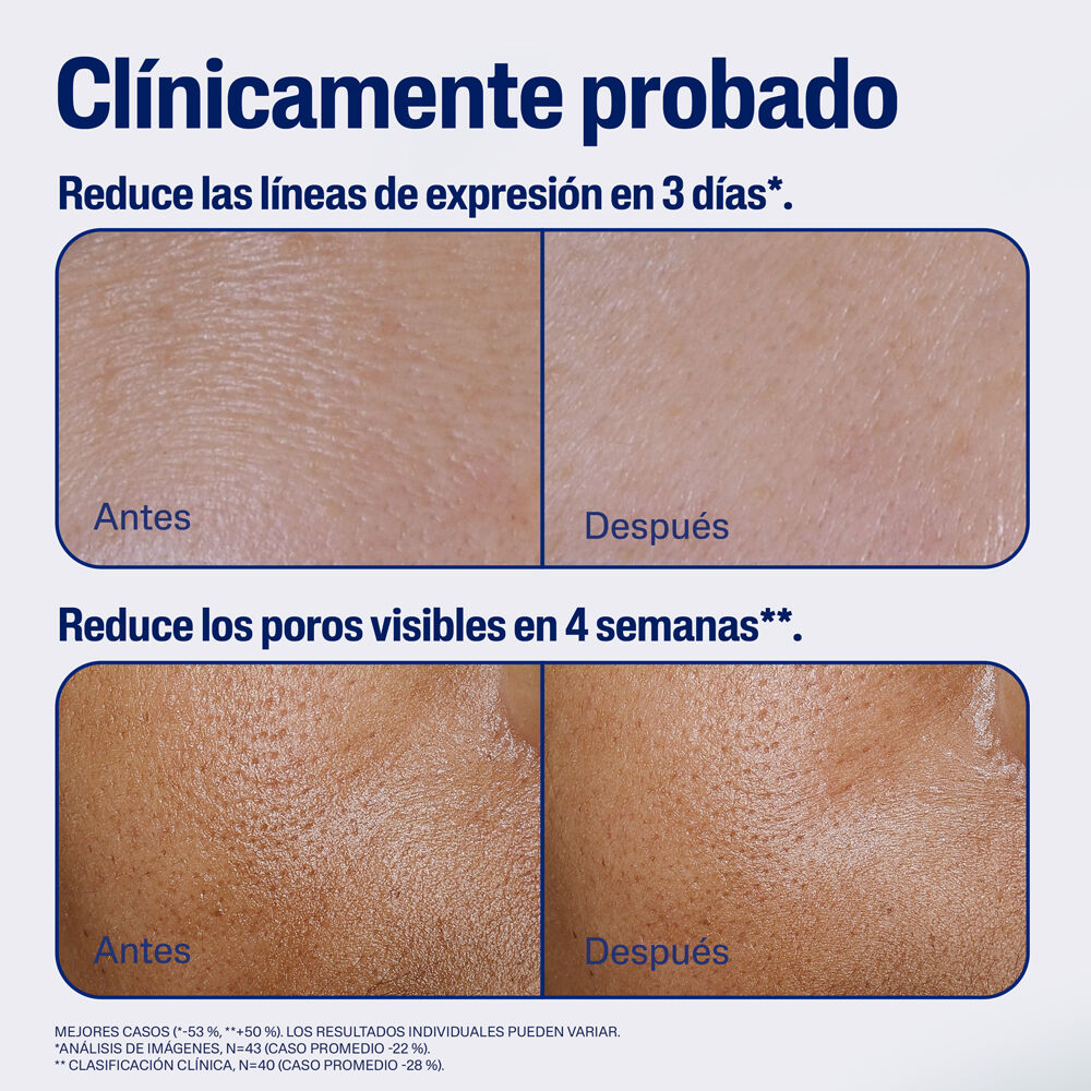 Serum AM antioxidante advance antes y despu&eacute;s neutraliza los radicales libres