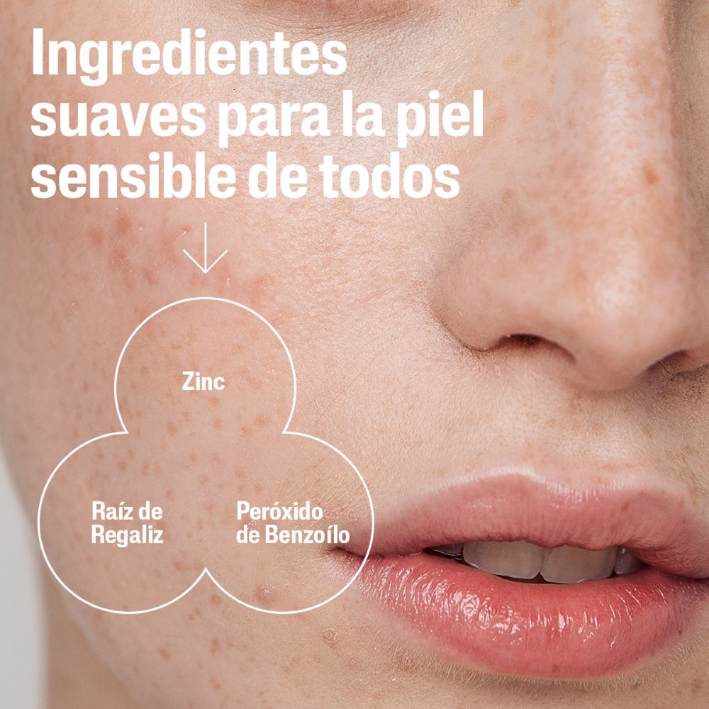 Oil Control Limpiador Facial Control Imperfecciones (236 mL)